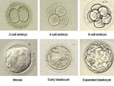 The development of the zygote up the blastocyst stage